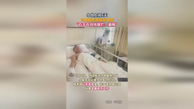 接觸輻射源會有什么癥狀_反饋實施和執(zhí)行力