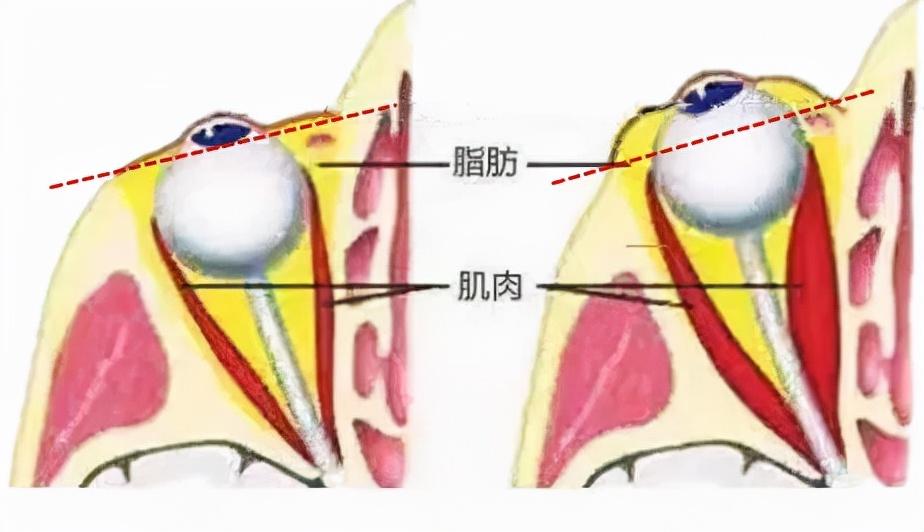 熬夜消耗甲狀腺壽命，警醒現代人，守護健康甲狀腺