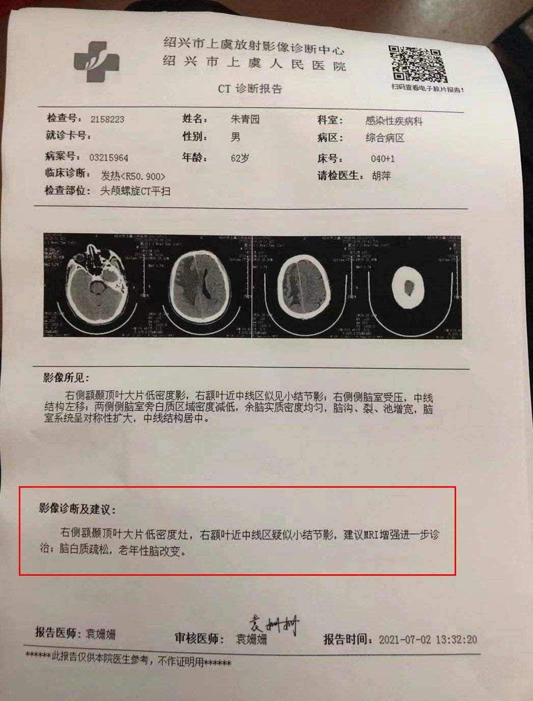 车祸后CT查出脑瘤医生未告知？探究事件背后的真相与责任