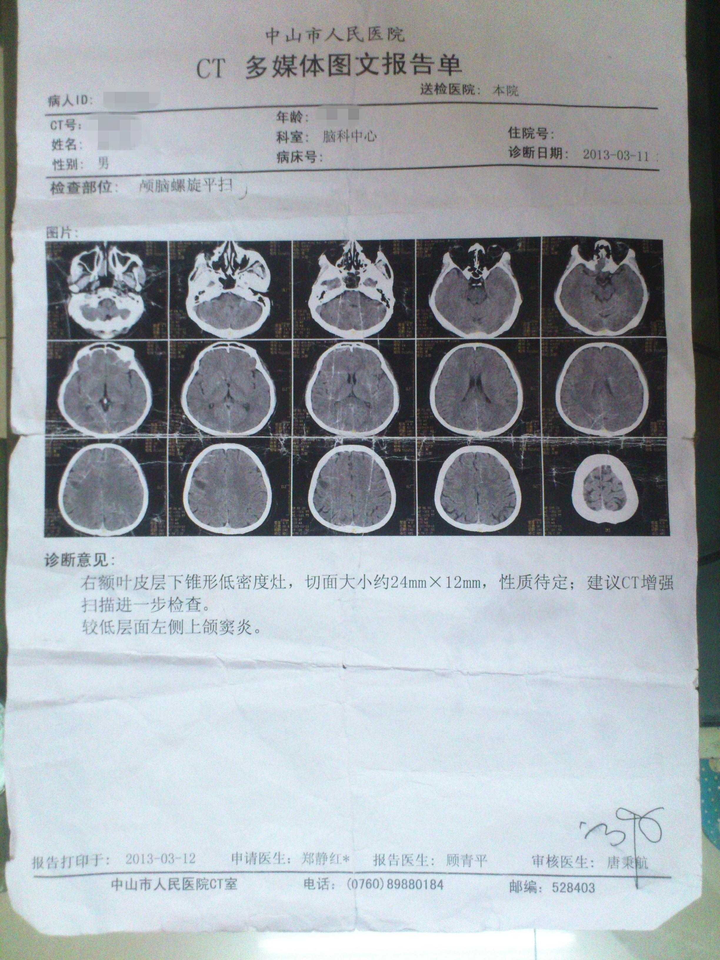 车祸后CT查出脑瘤医生未告知？探究事件背后的真相与责任