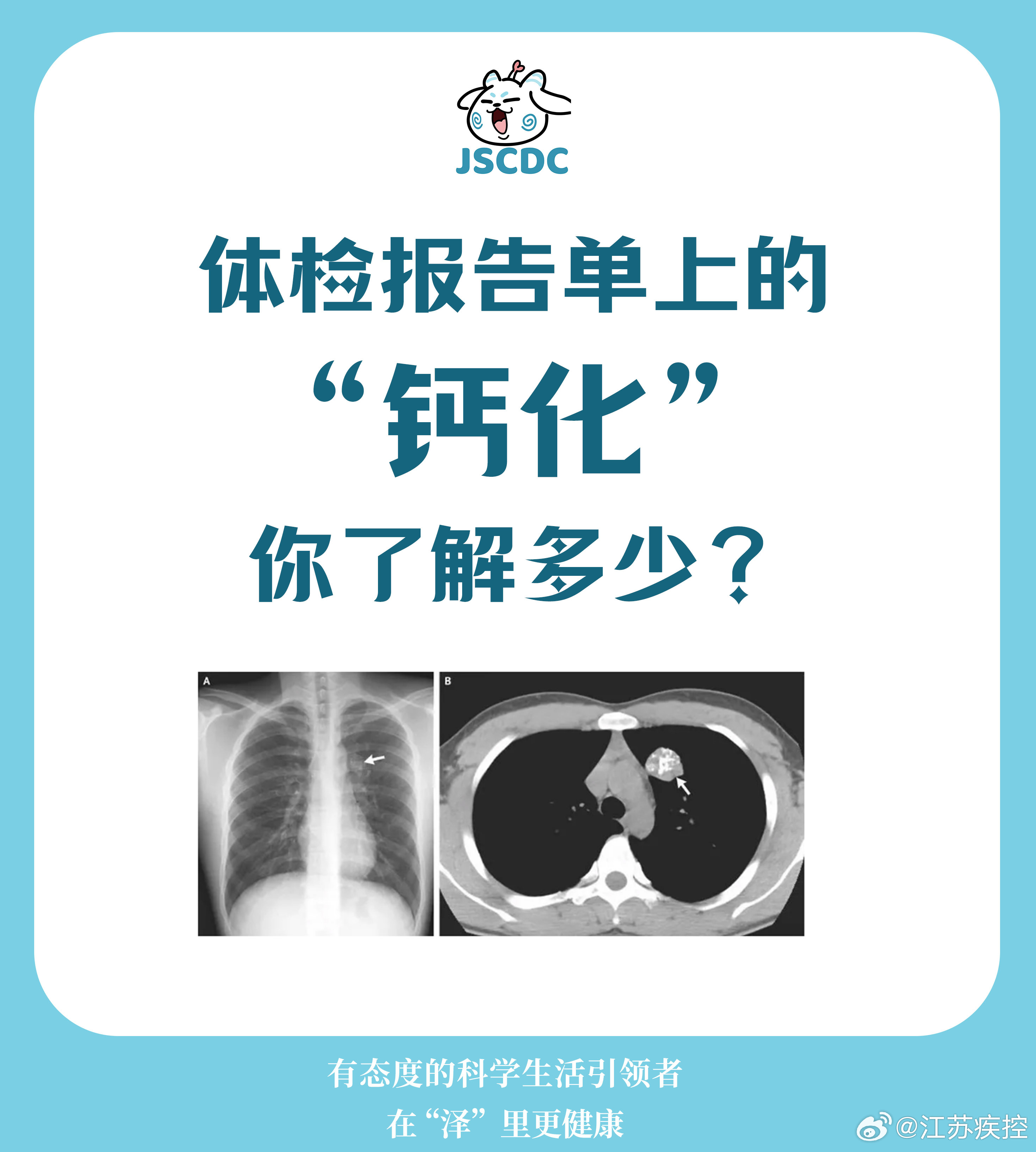 揭秘體檢報告中的鈣化真相，你不可不知的健康秘密！