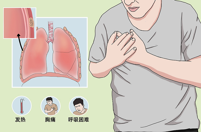 高瘦男性警惕！气胸隐患在你身边！